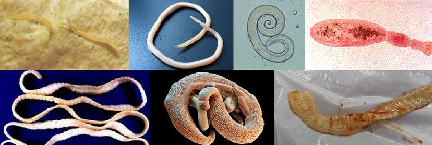 Diferentes tipos de parasitos