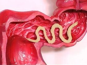 Parásitos no corpo humano, por que aparecen