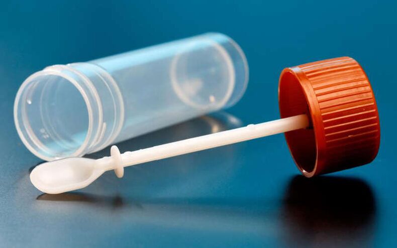 Proba de feces para vermes