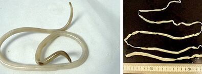 Tipos de parasitos no corpo humano