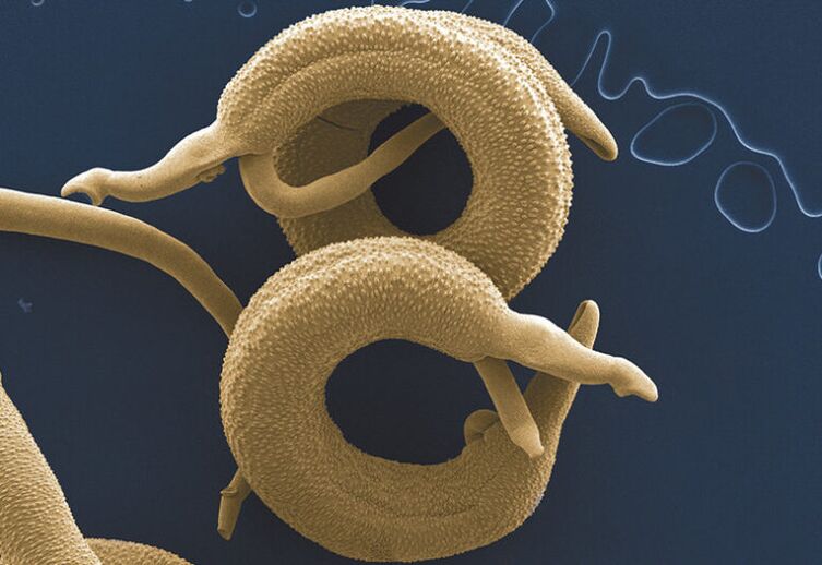 Parasitos que viven no corpo humano