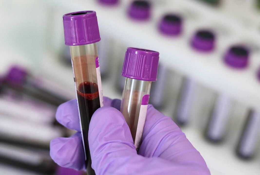 Análise de sangue para parasitos